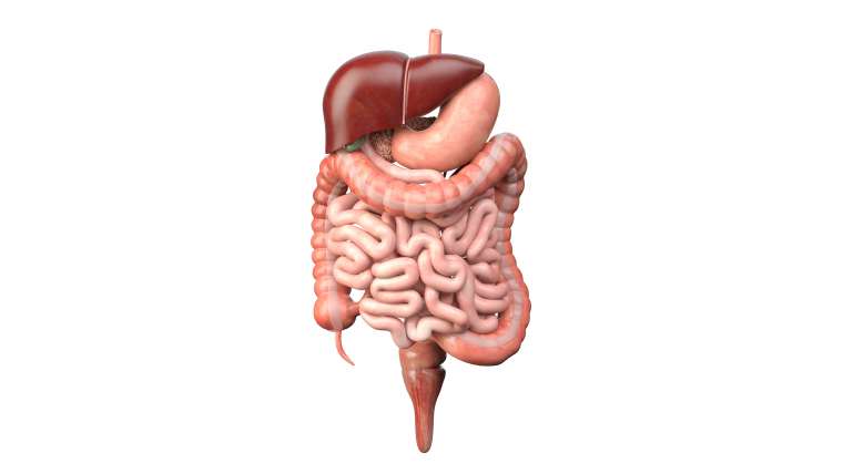 COLELITIASIS